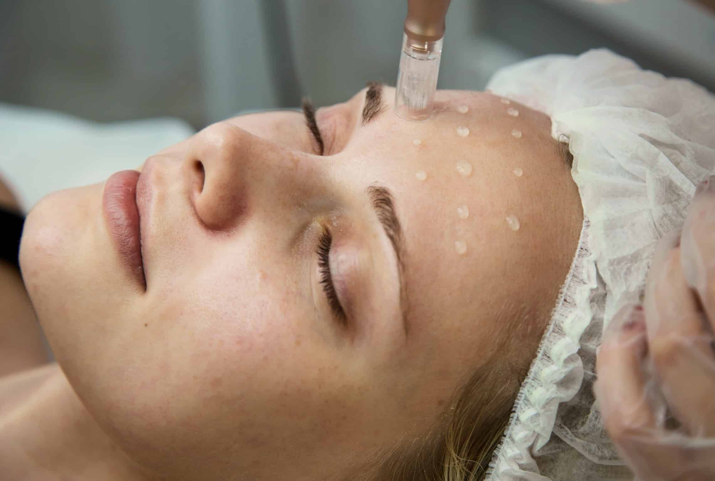 Outil medical applique des soins sur le visage d une femme mesotherapie | Dr Aida Cheriet Paris