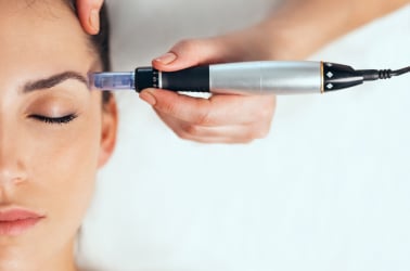 Appareil applique des soins sur le visage d une femme microneendling associe a la radiofrequence | Dr Aida Cheriet Paris